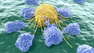 Lymphozyten attackieren eine Krebszelle (Quelle: imago/Science Photo Library)