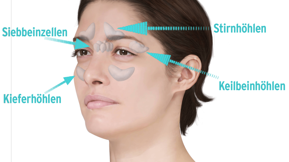 3D-Grafik der Nasennebenhöhlen auf Gesicht einer Frau (Bild: Imago/UiG/rbb)