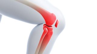 Teilgelenkersatz im Knie: Bild zeigt 3D-Grafik eines Knies (Bild: imago images/Science Photo Library)