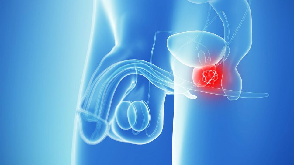 Prostatakrebs: Bild zeigt Grafik der Prostata im männlichen Unterleib (Bild: imago images/Science Photo Library)