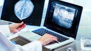 Symbolbild:Eine Ärztin schaut sich eine Mammografie an und gibt Daten in einen Computer ein.(Quelle:imago images/La Nacion)