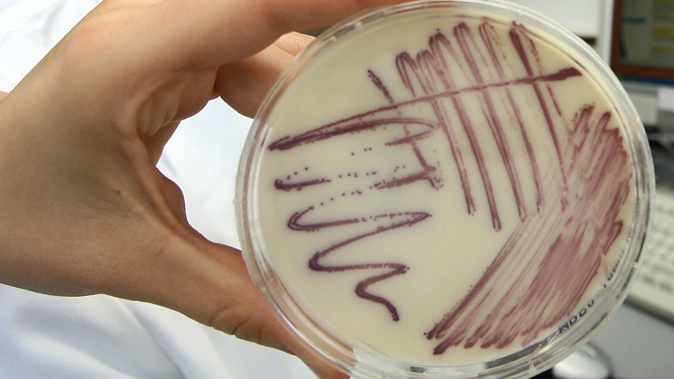 Eine Petrischale mit MRSA-Keimen (Methicillin-resistenten Staphylococcus aureus) (Bild: dpa)