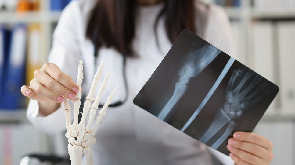 Ärztin mit Röntgenaufnahme und Modell einer Hand (Bild: Colourbox)