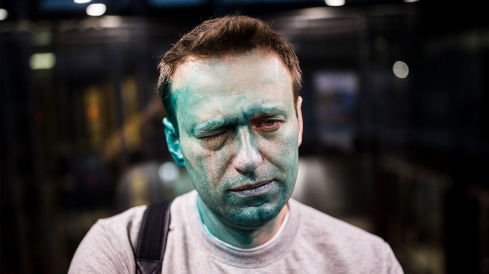Alexej Nawalny nach der Attacke mit einem grünen Desinfektionsmittel am 27.04.2017 in Moskau (Bild: rbb/arte/Evgeny Feldman)