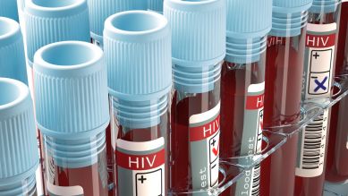 Röhrchen mit Aufdruck HIV; Bild: colourbox.com