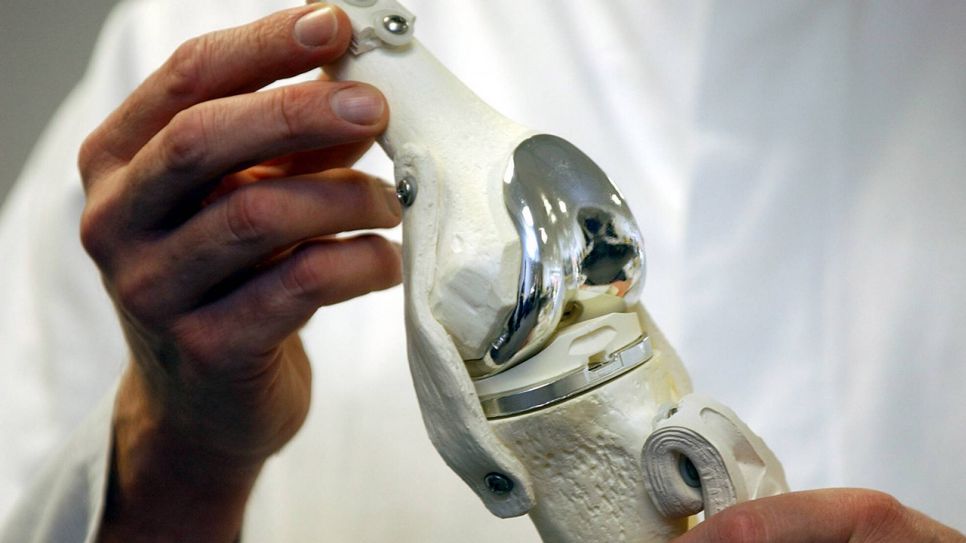 Arzt zeigt Modell eines künstlichen Kniegelenks (Quelle: imago/Garcia)
