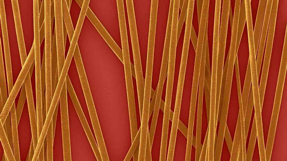 Mikoskopisch hochaufgelöste Darstellung von Haaren / Hornzellen (Quelle: imago/Science Photo Library)