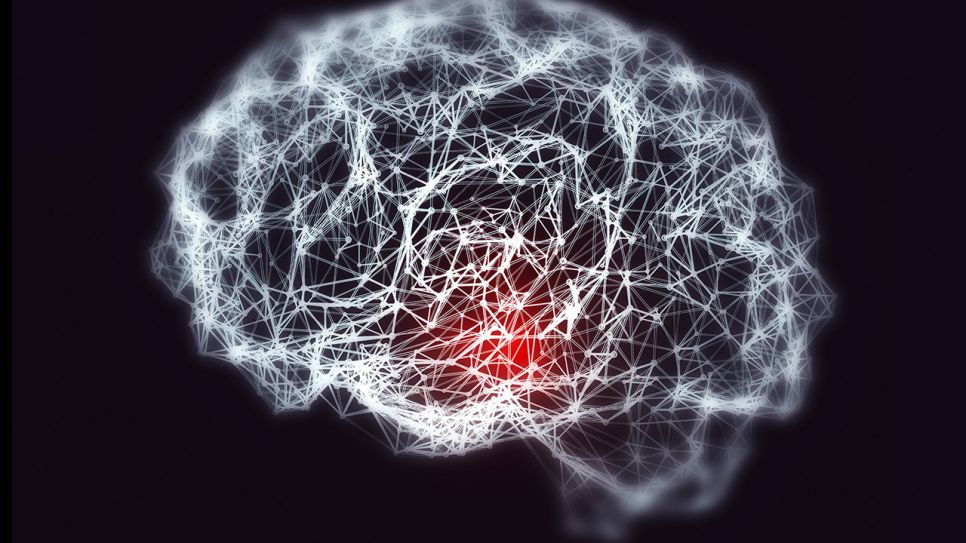 Illustration eines Gehrins mit Alzheimer- oder Demenzerkrankung (Quelle: imago/Science Photo Library)