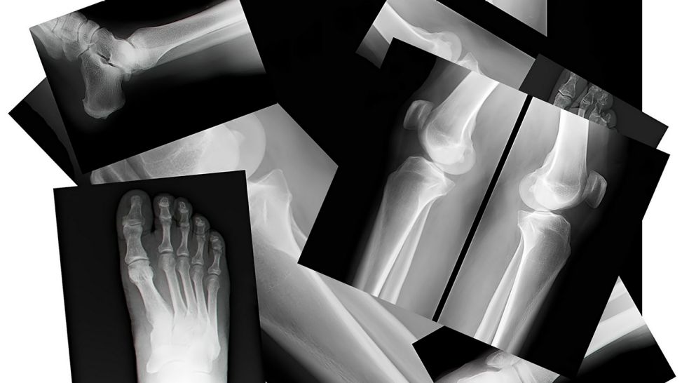 Röntgenbilder auf einem Haufen (Bild: Colourbox)