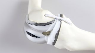 Knieprothese an einem Knochenmodell (Quelle: imago/Jochen Tack)