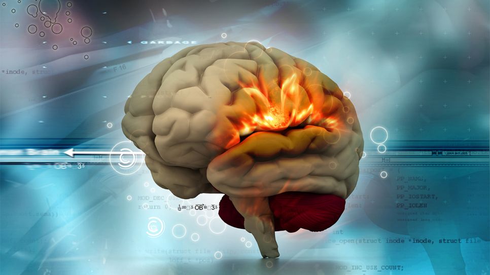 3D-Grafik: Infarkt im Gehirn (Bild: Colourbox)