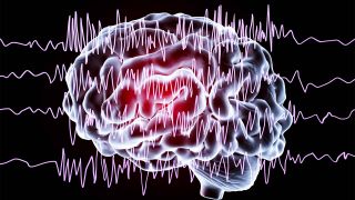 3D Grafik Epilepsie (Bild: imago images/Science Photo Library)