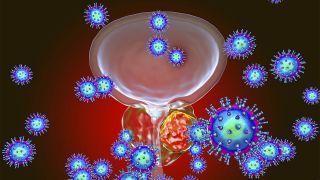 3D Grafik einer Prostata mit Viren und Krebszellen (Bild: imago images/Science Photo Library)