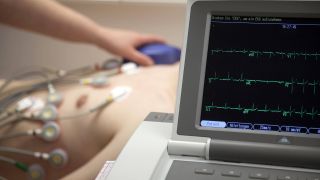 EKG und Herzschrittmacherkontrolle eines Patienten (Bild: imago images/Rupert Oberhäuser)