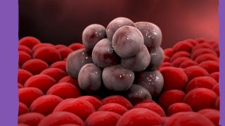 3D-Modell von Tumorzellen auf gewöhnlichen Zellen (Bild: imago images/StockTrek Images)