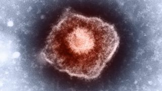 Herpes Zoster Virus unter Elektronenmikroskop (Bild: Imago Images/Science Photo Library)
