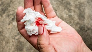 Verletzte Hand hält blutiges Taschentuch (Bild: imago images/agefotostock)