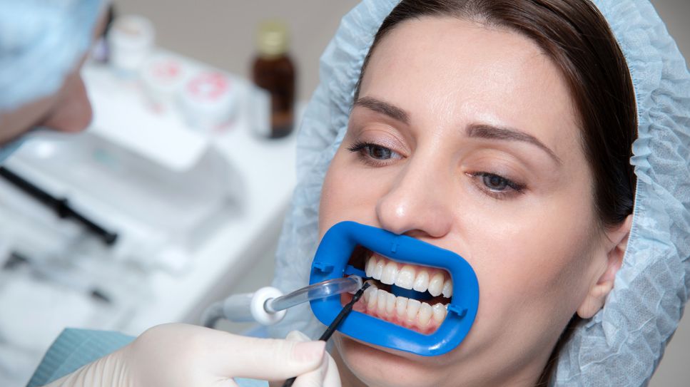 Patientin mit Mundspreitzer im Mund bei Zahnarztbehandlung (Bild: imago images/agefotostock)