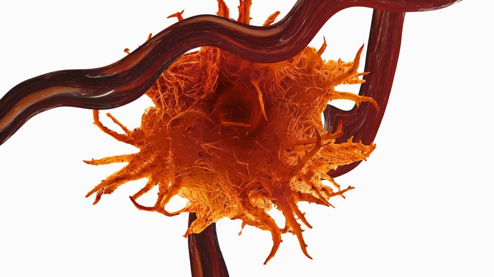 3D-Abbildung einer vergrößerten Krebszelle (Bild: imago images/Cavan Images)