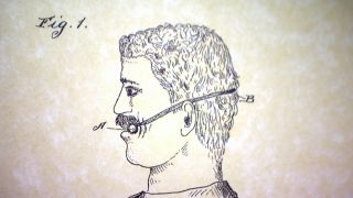 Zeichnung von Mundwerkzeug gegen Schnarchen (Bild: rbb)