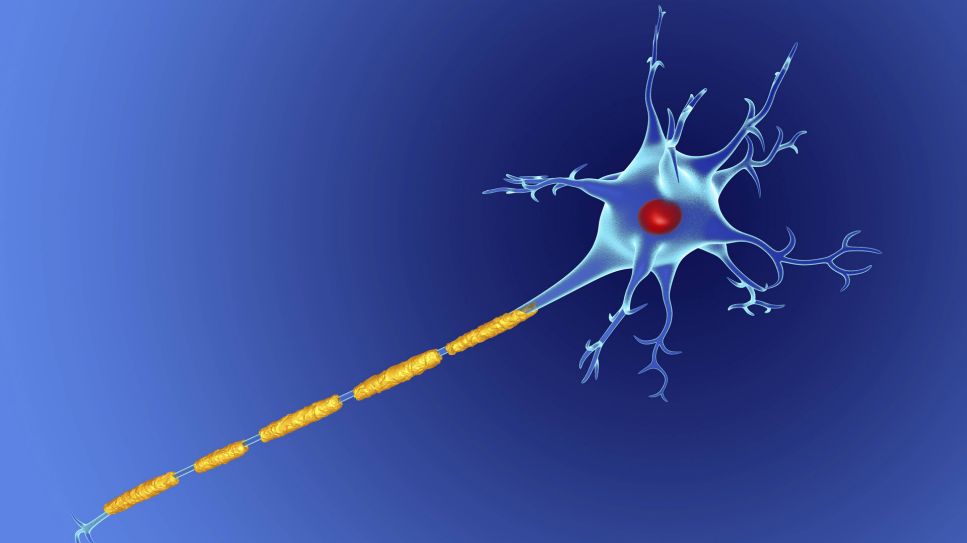 Nervenzelle mit einer zerstörten Myelinschicht (Quelle: imago/Science Photo Library)