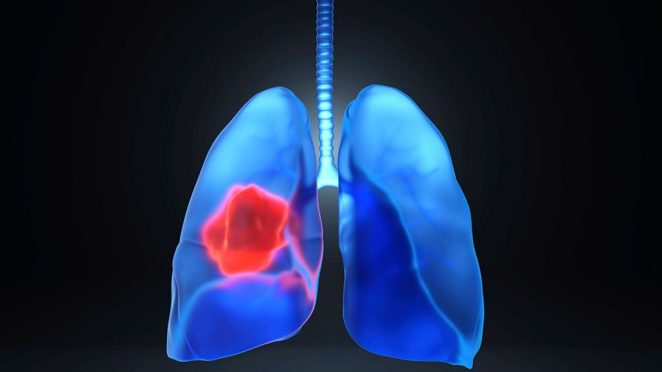 3D-Abbildung einer Lunge (Bild: imago/Westend61)