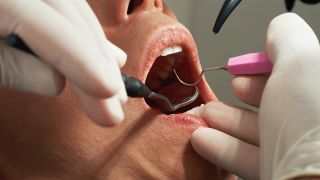 Schmerzfrei beim Zahnarzt: Offener Mund bei zahnmedizinischer Behandlung (Bild: unsplash/Caroline LM)