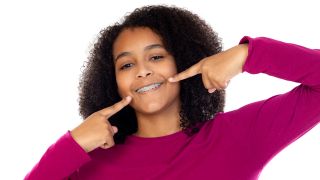 Junge Frau zeigt auf die Zahnspange in ihrem Mund (Quelle: colourbox)