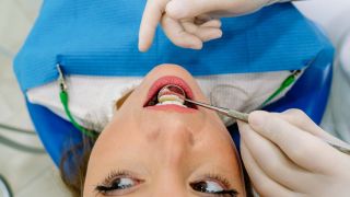 Teure Extras beim Zahnarzt: Frau liegt auf Zahnarztstuhl (Bild: imago/Addictive Stock)