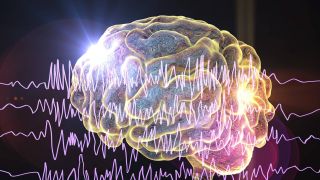 Epilepsie: Grafik zeigt ein Gehirn mit EEG Auswertung (Quelle: imago/Science Photo Library)