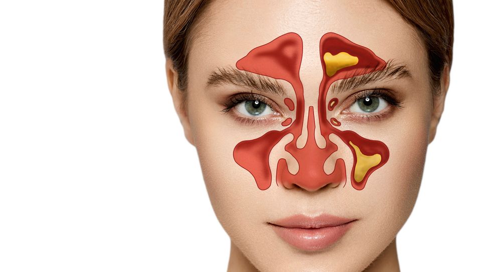 Nasennebenhöhlenentzündung: 3D-Grafik der Nasennebenhöhlen auf Gesicht einer Frau (Bild: Imago/Science Photo Library)