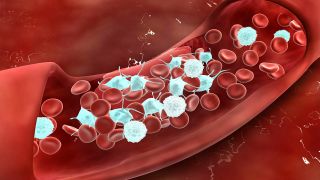 Thrombose: Bild zeigt 3D-Grafik eines Blutgerinnsels im Gefäß (Bild: imago images/Stock Trek Images)