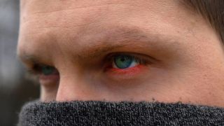 Trockene Augen im Winter: Bild zeigt Mann mit roten Augen und Schal um den Mund (Bild: imago images/Bihlmayerfotografie)
