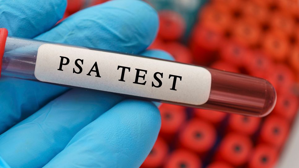 PSA-Test bei Verdacht auf Prostatakrebs: Bild zeigt Blutprobe mit Beschriftung "PSA Test" (Bild: imago images/Science Photo Library)