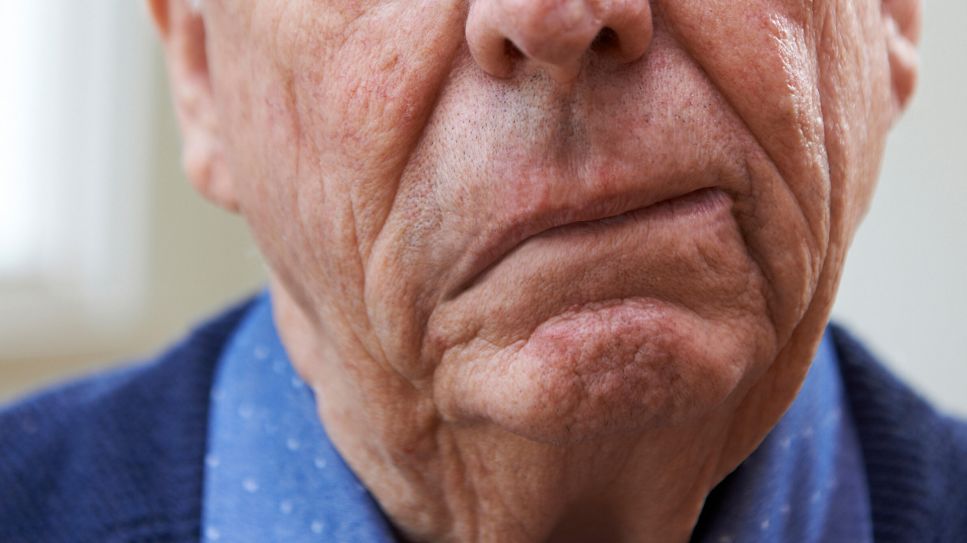 Fazialisparese: Bild zeigt älteren Mann mit Gesichtslähmung (Bild: Imago Images/agefotostock)