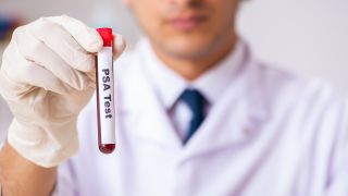 PSA-Test: Bild zeigt Arzt mit Blutprobe für PSA-Test auf Prostatakrebs (Bild: Colourbox)