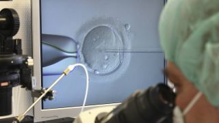 Eizellen freezing bei Endometriose: Bild zeigt menschliche Eizelle unter Mikroskop (Bild: imago images/EPD)