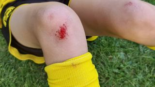Schürfwunde: Bild zeigt Knie eines jungen Fußballspielers mit blutiger Abschürfung (Bild: imago images/blickwinkel)