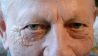 Nachgefragt Grauer Star: Die Augen von Patient Karl-Heinz Reimann sehen jetzt wieder scharf