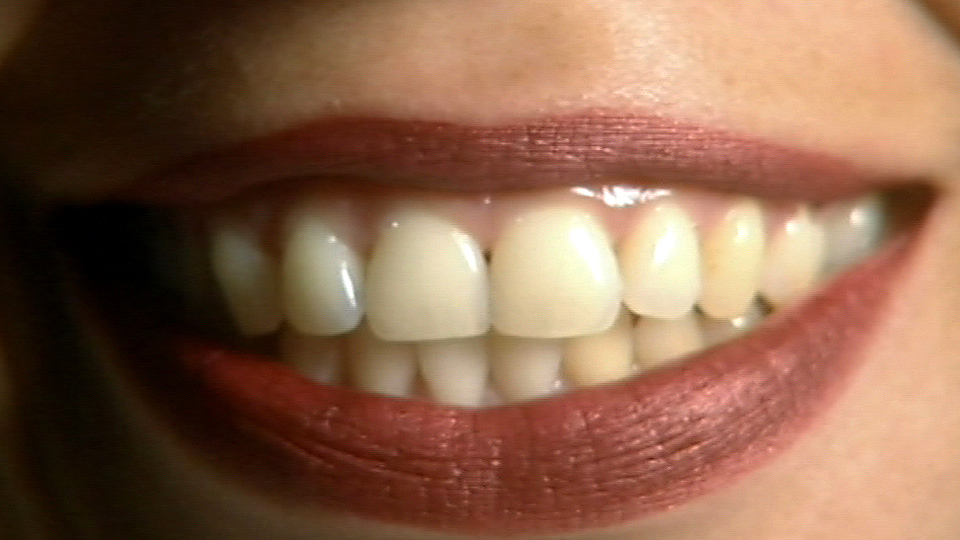 Zähne einer Frau (Quelle: rbb)