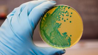 Listerien-Zellen im Labor (Quelle: imago images/Wirestock)