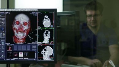 Spiegelbild von Sven Hartwig auf einem Monitor mit einem CT-Scan (Quelle: rbb)