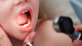 Symbolbild:Mit einem Otoskop untersucht eine Kinderärztin den Mund und Hals eines Mädchens.(Quelle:picture alliance/dpa/C.Charisius)